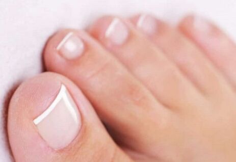 Nagelgesundheit