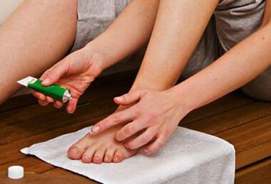 Tragen Sie eine Salbe zur Behandlung von Zehennagelpilz auf